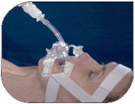 Endotracheal Tube Holder